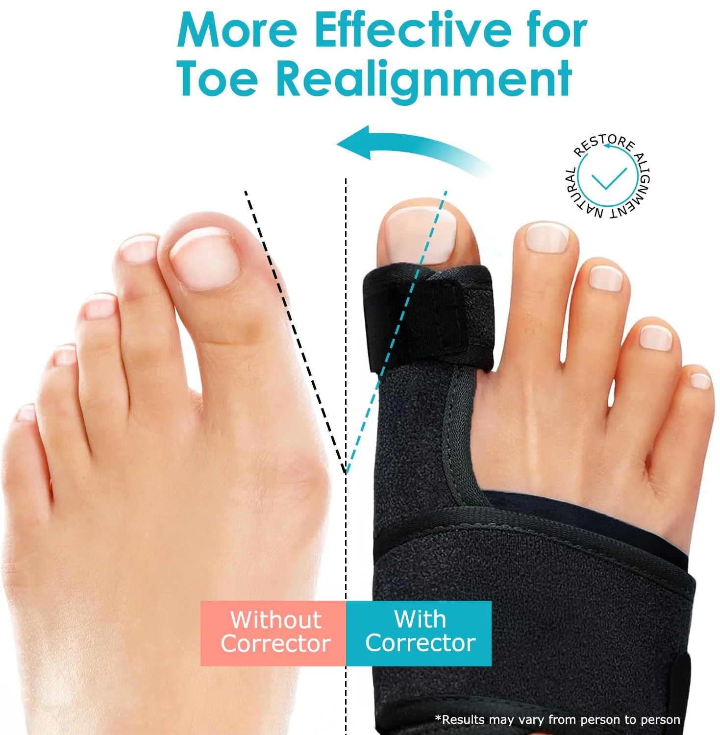 VISOOP Toe Straighteners Bunion Corrector Alignment Bar Support Device in DEMO - Image 2