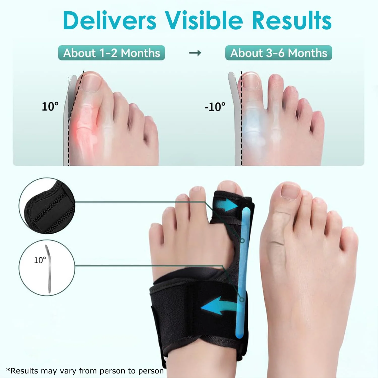 VISOOP Toe Straighteners Bunion Corrector Alignment Bar Support Device in DEMO - Image 4