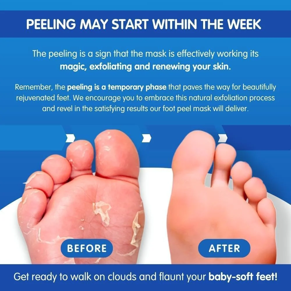 Imperial Feet Pedicure Foot Masks - Smooth, Soften & Peel Dry, Cracked Skin NEW - Image 8