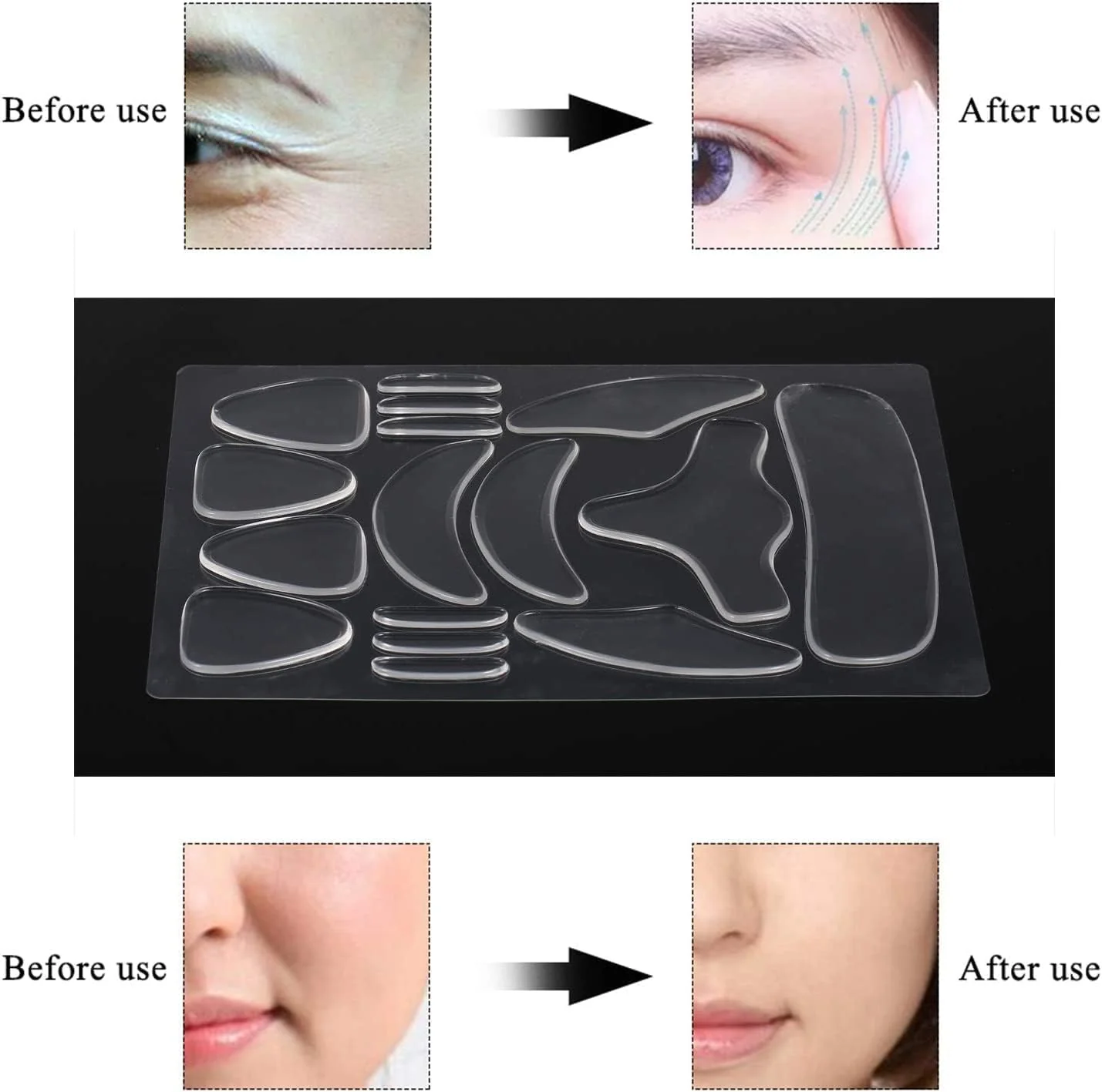 TOYSS Transparent Masks Facial Forehead Anti Wrinkle Patches, 16 Pcs, Skin NEW - Image 6